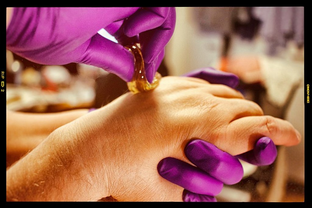 Sugaring hair removal