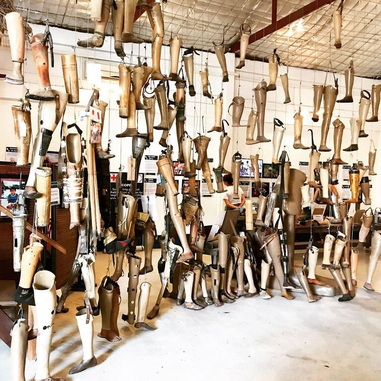 pay a visit to the cooperative orthotic and prosthetic enterprise