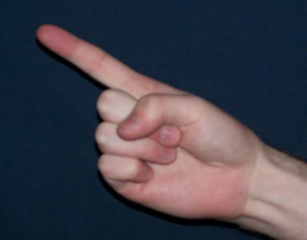 Index finger 2